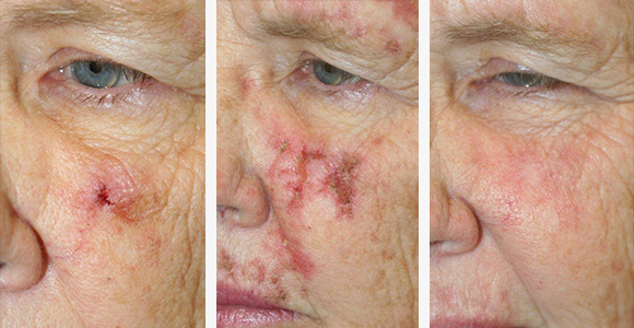 Non Surgical